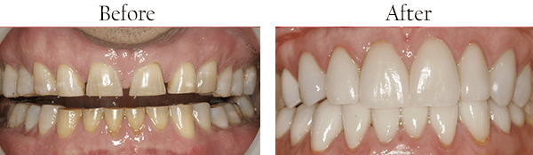 Smile Gallery, Surrey Dentist